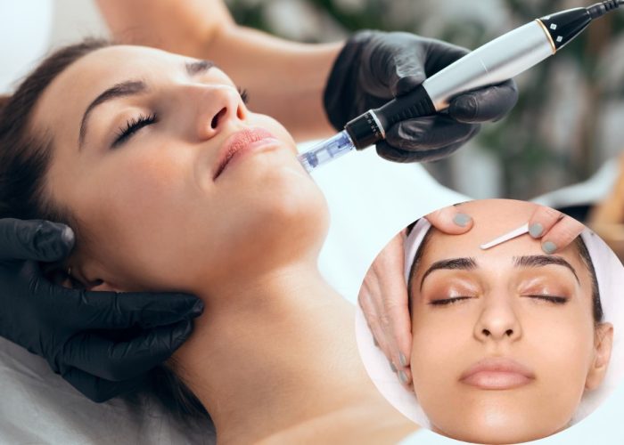 Microneedling-with-Dermaplaning-NYC-Manhattan-Skin-Care-Clinic-Face-Glow-NYC